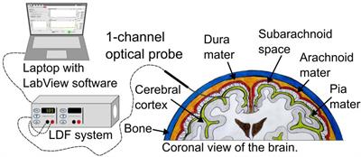 Analysis of laser Doppler flowmetry long-term recordings for investigation of cerebral microcirculation during neurointensive care